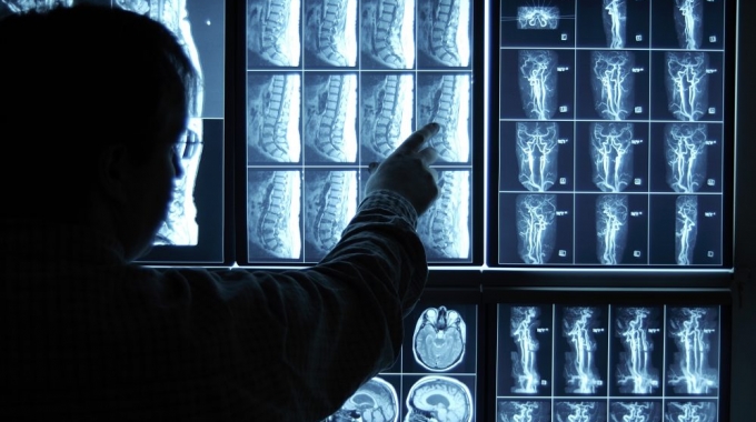 What Artificial Intelligence Can Do for Radiology
